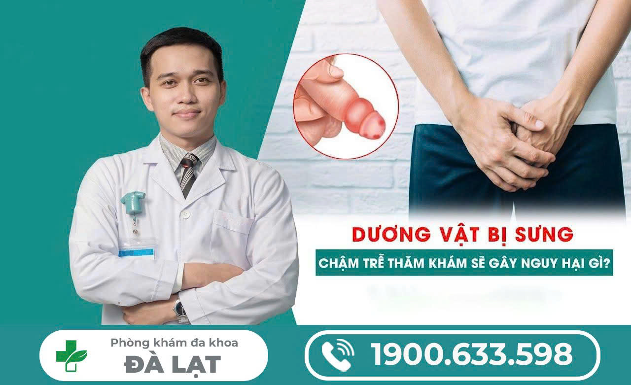 Hình ảnh minh họa